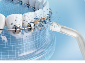 ORTHODONTIC HEAD