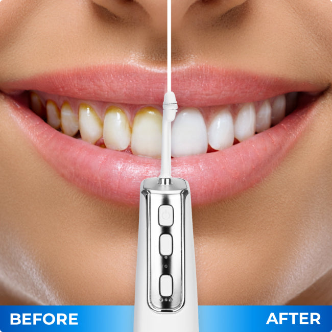 Miracle Smile Magic Flosser