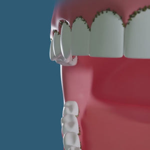 Miracle Smile H-Shaped Replacement Heads